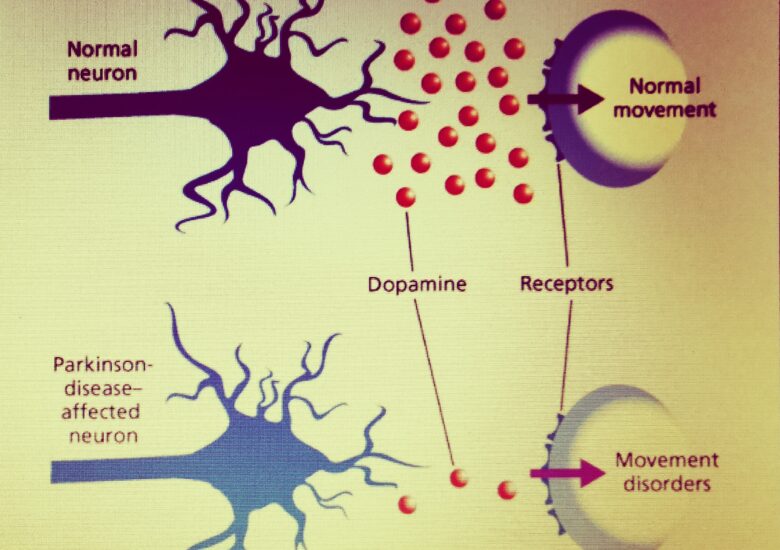 Parkinson, boala genetica?