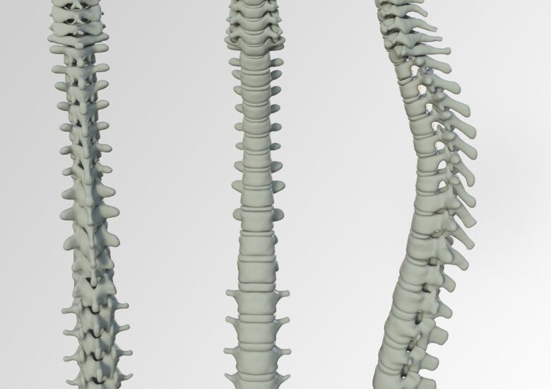 Coloana Vertebrală