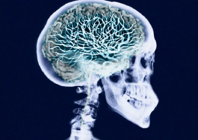 Ce trebuie să știți despre scleroza multiplă și convulsii?