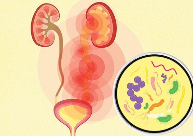 Infecția tractului urinar în scleroza multiplă: risc, diagnostic și management
