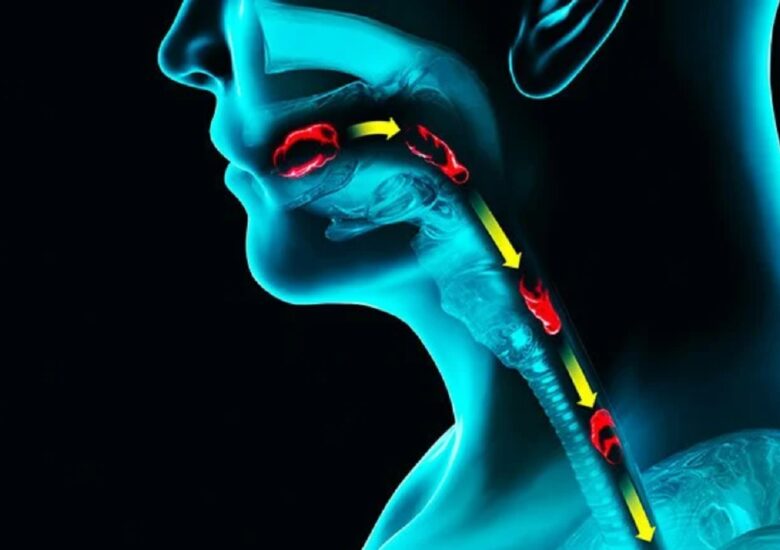 Cum să gestionați disfagia legată de scleroza multiplă
