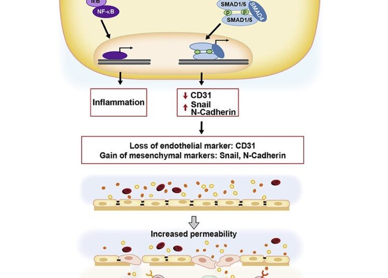 O descoperire a oamenilor de știință care sugerează o strategie terapeutică alternativă în tratarea SM