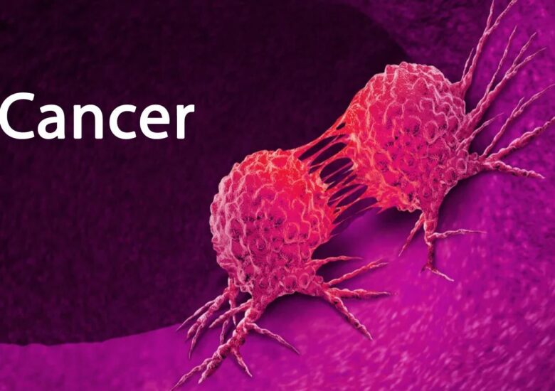 Este Scleroza Multiplă legată de un risc crescut de cancer?