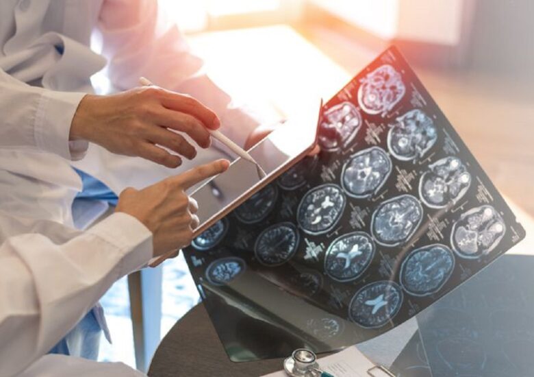 Artrita psoriazică vs. scleroza multiplă: simptome, cauze, tratament