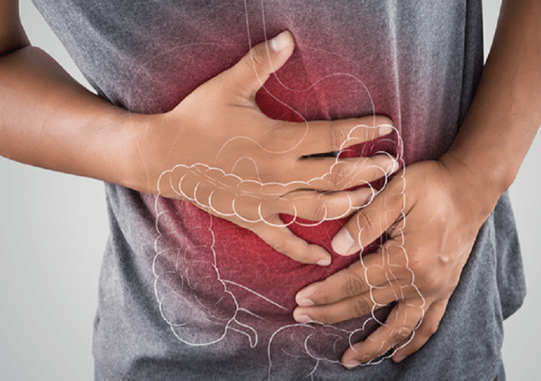 Constipația  în scleroza multiplă