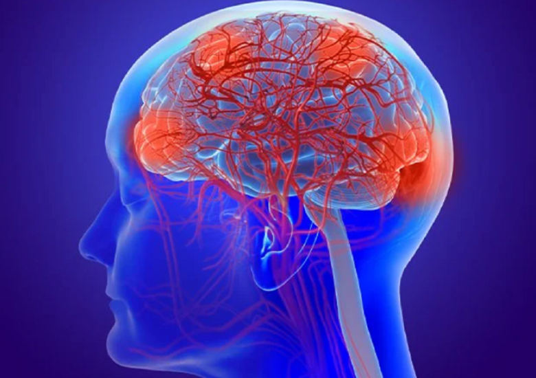 Leziuni cerebrale ale sclerozei multiple și efectele lor. Cum poate afecta scleroza multiplă trunchiul cerebral