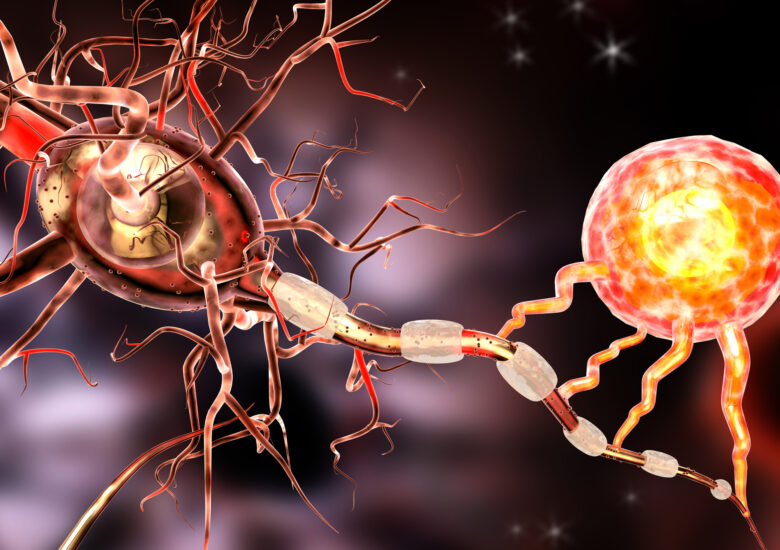 Este scleroza multiplă sau boala țesutului conjunctiv?