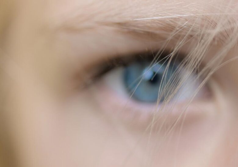 Fenomenul lui Uhthoff în scleroza multiplă. De ce o creștere a temperaturii corpului poate declanșa simptome de scleroză multiplă??