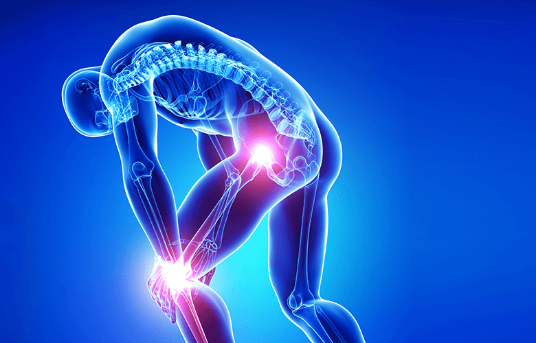 Durerile de șold și genunchi în scleroza multiplă. Problemele nervoase și musculo-scheletice pot fi de vină