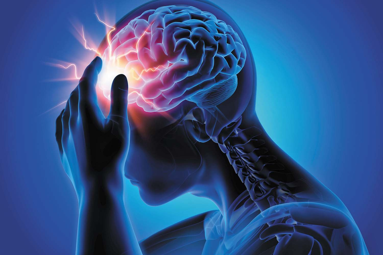 O privire de ansamblu asupra durerilor de cap în boala sclerozei multiple