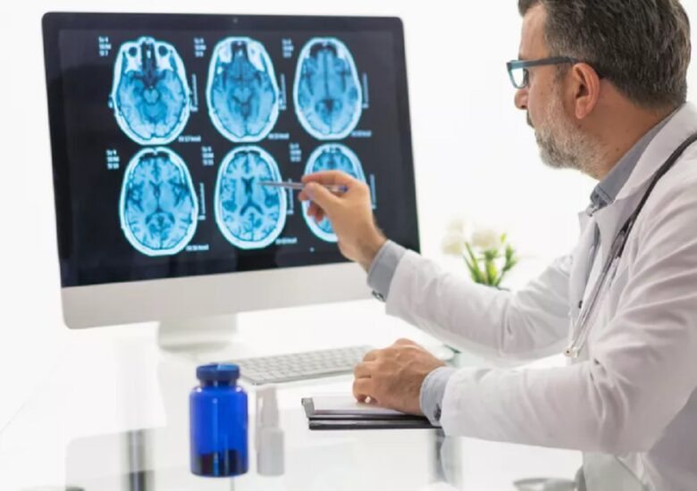 RMN pentru scleroza multiplă: Cum arată SM?