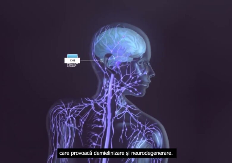 Neurofilamentele